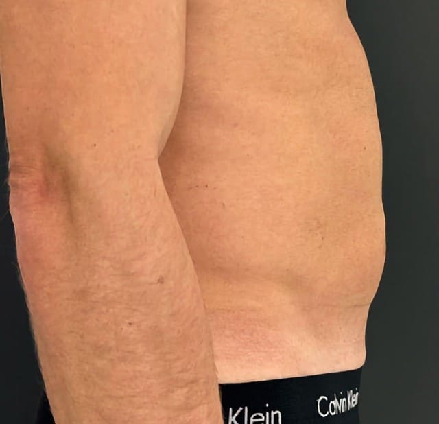 Abdominal-Dr.-Virginia-Benitez-Roig-1-Baseline