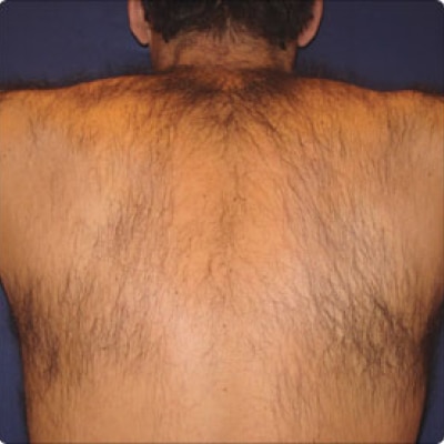 rakus-soprano-beforeafter3