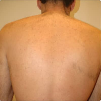 rakus-soprano-beforeafter32