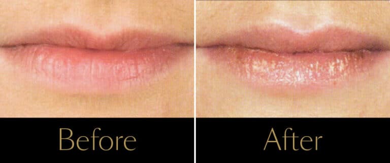 BA-Lips-1