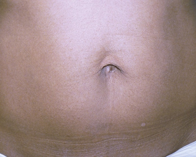 Rakus-Exilis-BAs2