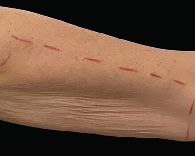 Rakus-Exilis-BAs3