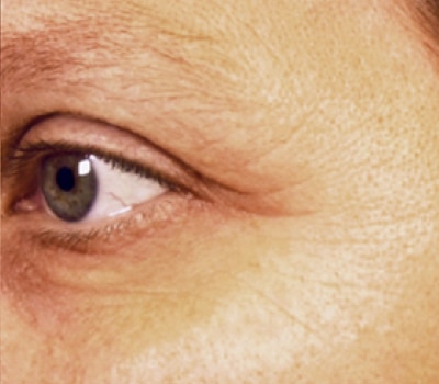 rakus-pelleve-beforeafter2